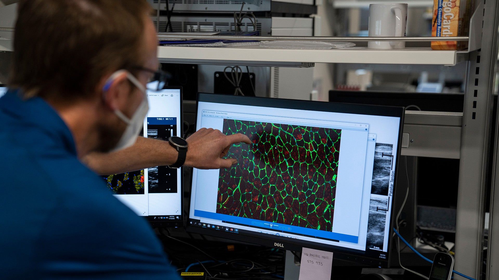 Damien Callahan looking at muscle tissue on microscope screen